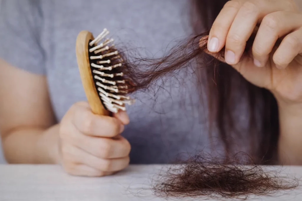 effluvium_telogene_oderma_clermontferrand