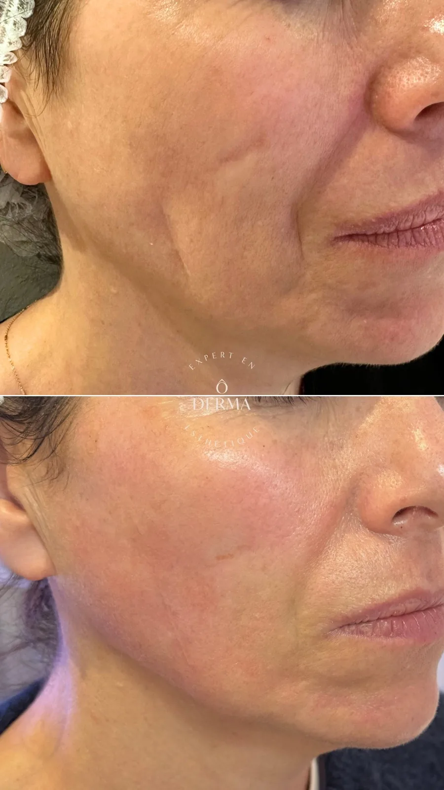 ovale_visage_soin_antiage_oderma_clermont-ferrand