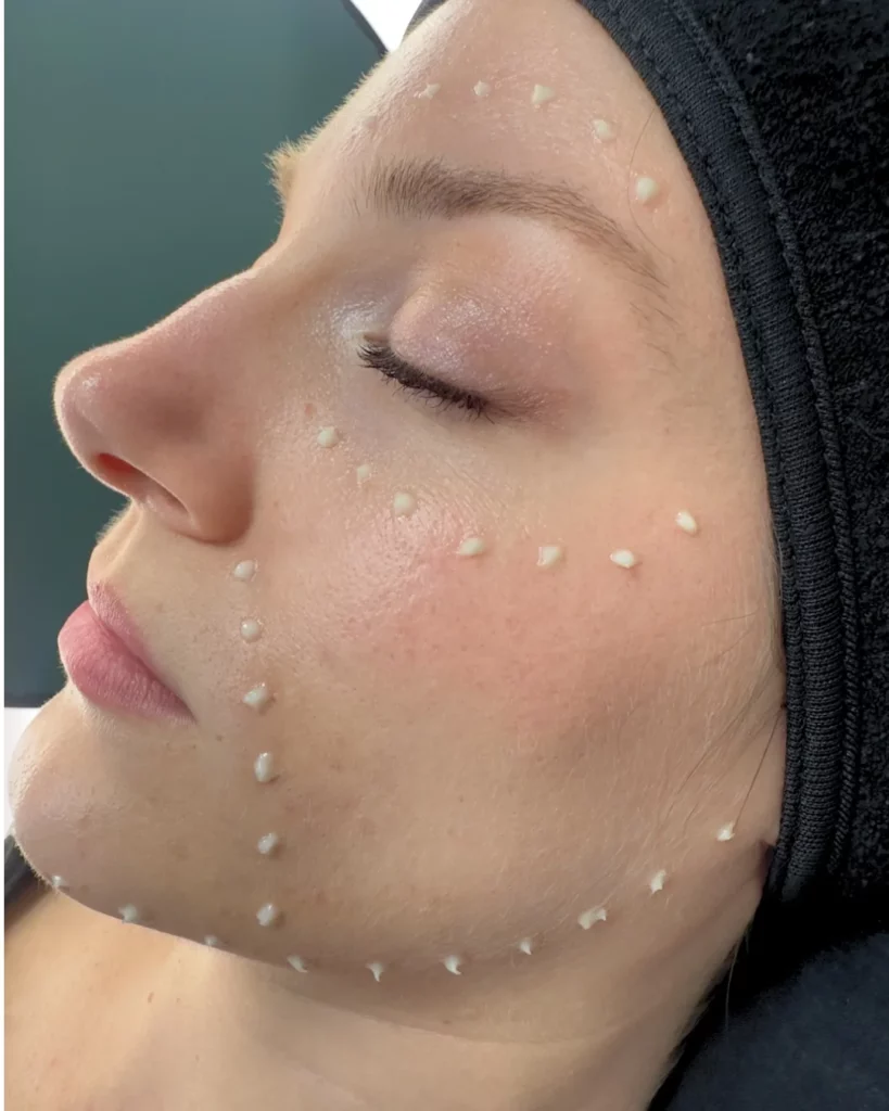 pdrn_antiage_soin_visage_oderma_clermont-ferrand