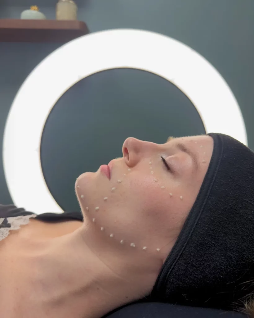 pdrn_kbeauty_skincare_oderma_clermont-ferrand