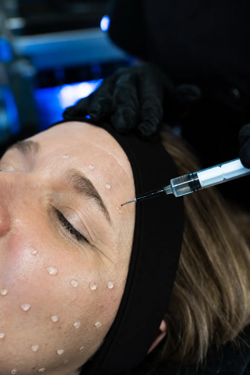 Soin PRX-T33 du visage chez Ô Derma à Clermont-Ferrand pour améliorer la qualité de peau, l’éclat et la fermeté.